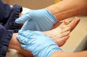 The Basics of Diabetic Foot Care