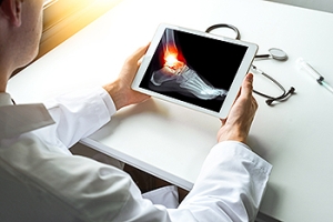X-Ray Needed for a Broken Ankle