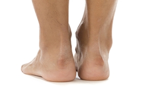 What Is a Haglund’s Deformity?